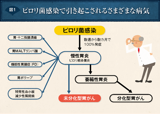 図1 ピロリ菌感染で引き起こされるさまざまな病気